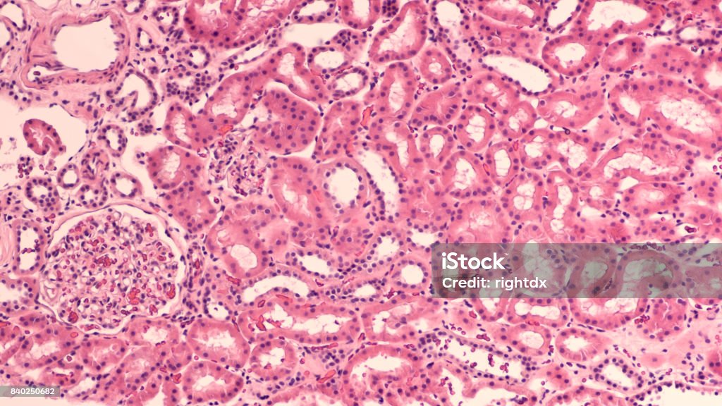 Kidney Histology Photomicrograph of normal human kidney, with collecting tubules and single glomerulus (lower leftt) Biological Cell Stock Photo