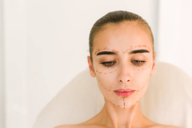 istock Correction lines on woman face. 840477294