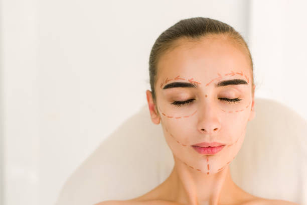 istock Attractive girl with correction lines on her face. 840477352