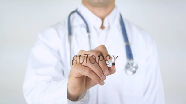 istock Autopsy , Doctor Writing on Glass 840500528