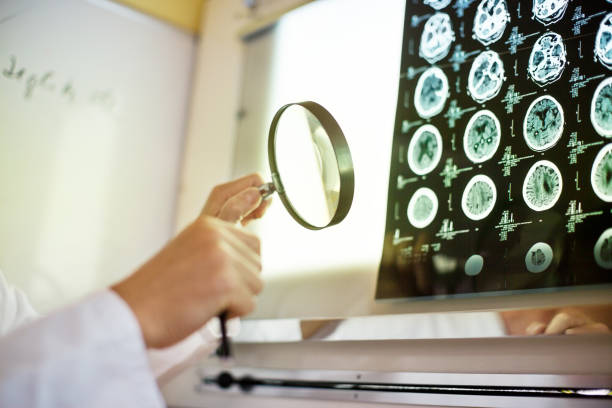 istock Doctor analyzing the MRI scans with magnifying glass 840512734