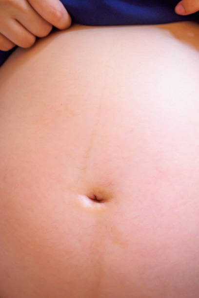 istock pregnancy woman 840806124