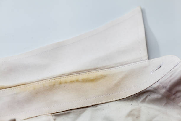 Yellow collar stain on white dirty shirt