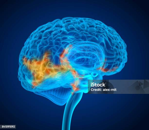 Scansione A Raggi X Del Tumore Al Cervello Umano Illustrazione 3d Medicalmente Accurata - Fotografie stock e altre immagini di Cancro al cervello