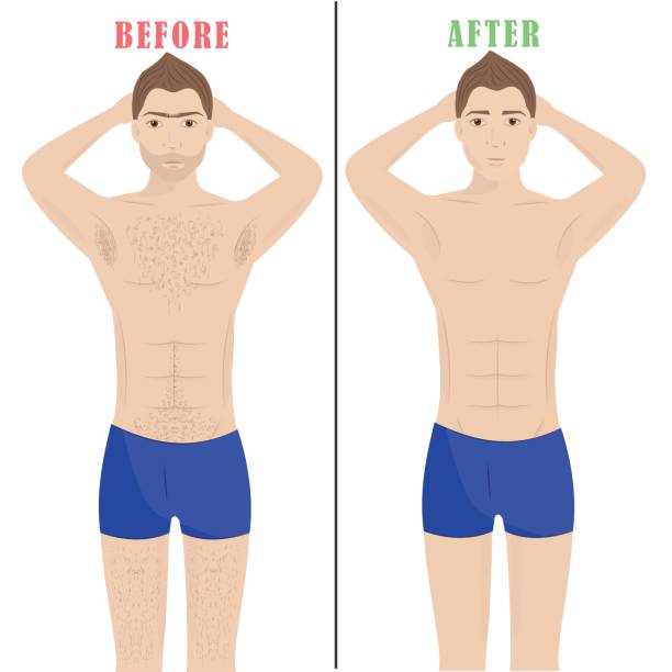 illustrazioni stock, clip art, cartoni animati e icone di tendenza di depilazione dell'uomo. depilazione laser. epilazione maschile. - hairy men shaving chest