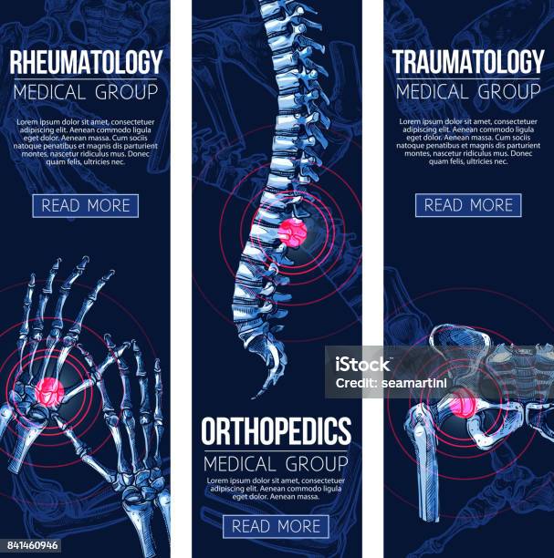 Vecteur Médical Bannières Rhumatologie Traumatologie Vecteurs libres de droits et plus d'images vectorielles de Colonne vertébrale - Partie du corps