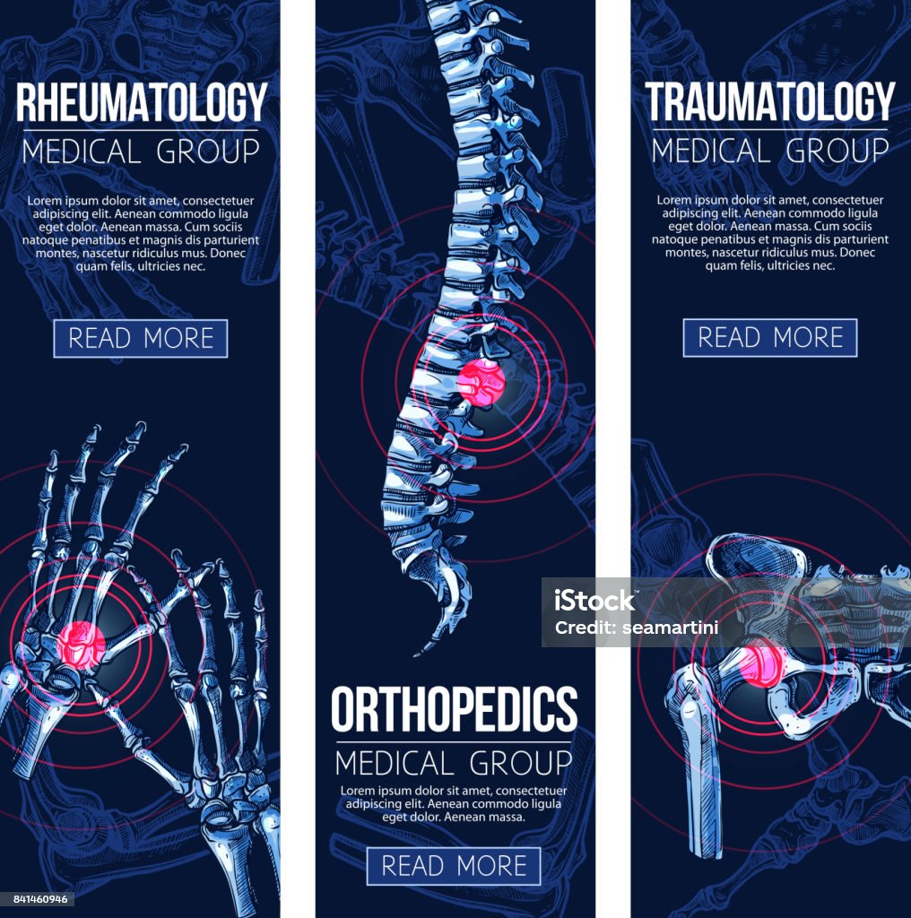 Medical vector banners rheumatology traumatology Rheumatology and orthopedics traumatology medicine banners. Vector set of medical x-ray of human body bones and joints for leg knee or foot, spine and arm hand trauma, and wrist arthritis Spine - Body Part stock vector