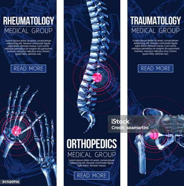 Medical Vector Banners Rheumatology Traumatology Stock Illustration - Download Image Now - Spine - Body Part, Human Spine, Rheumatology