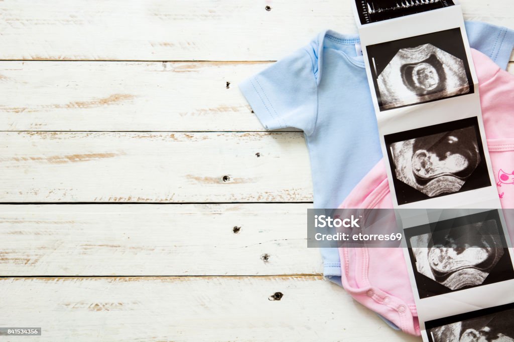 Pink and blue baby romper and ultrasound on white wooden background Pink and blue baby romper and ultrasound on white wooden background.Copyspace Ultrasound Stock Photo