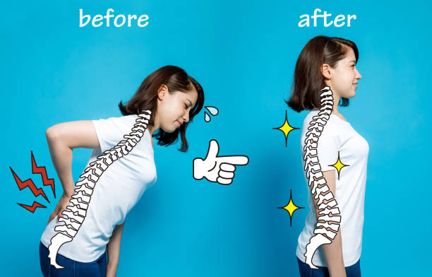 chiropractic before after image. from bad posture to good posture. woman's body and backbone. chiropractic before after image. from bad posture to good posture. woman's body and backbone. good posture stock pictures, royalty-free photos & images