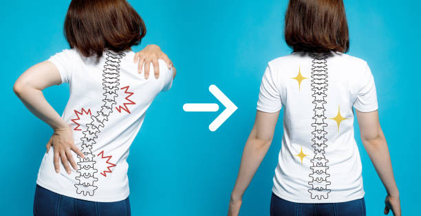 イメージの後の前にカイロプラクティック。良い姿勢悪い姿勢は。女性の体とバックボーン。 - human spine posture back backache ストックフォトと画像