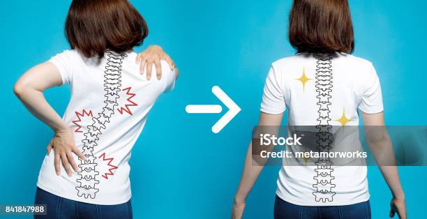 Chiropractic Before After Image From Bad Posture To Good Posture Womans Body And Backbone Stock Photo - Download Image Now
