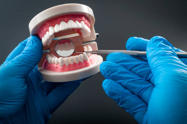 zahnarzt zähne mit einem gebogenen mundspiegel überprüfen - dental hygiene laboratory dental equipment technician stock-fotos und bilder