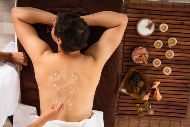 Relaxed Young Man Receiving Cupping Treatment On Back High Angle View Of A Relaxed Young Man Receiving Cupping Treatment On Back cupping therapy stock pictures, royalty-free photos & images