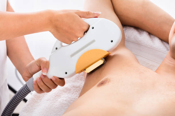 istock Man Having Underarm Laser Hair Removal Treatment 842210152