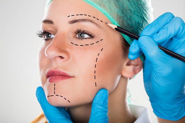 Surgeon Drawing Perforation Lines On Woman's Face Close-up Of A Surgeon Drawing Perforation Lines On Young Woman's Face plastic surgery photos stock pictures, royalty-free photos & images