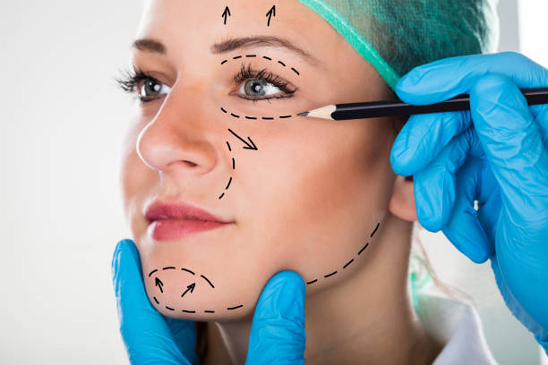 外科醫生做整形手術的女人的臉上繪製線條 - 整形手術 個照片及圖片檔