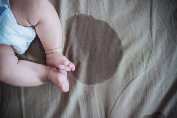 i piedi del bambino bagnano il letto e le macchie - enuresis foto e immagini stock