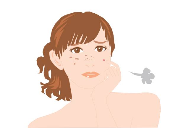 ilustraciones, imágenes clip art, dibujos animados e iconos de stock de problemas de espinillas, manchas y freckles(woman) - health spa illustration and painting women beautiful