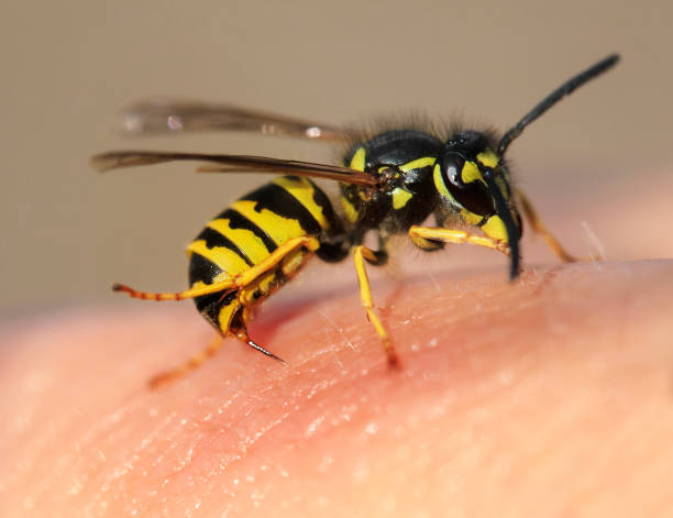 gestreifte böse wespe stecken einen scharfen dorn in der menschlichen haut - insektenstachel stock-fotos und bilder