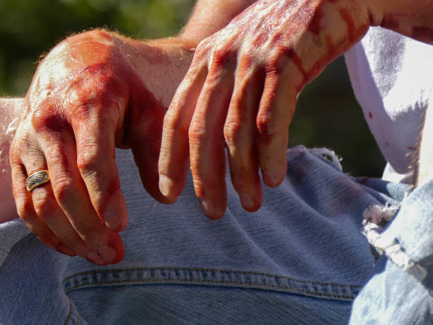istock Wounded male sitting helplessly hands covered blood 842735600