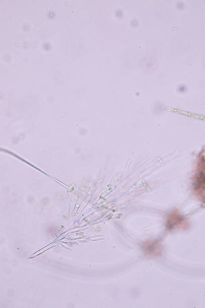 dinobryon is a type of microscopic algae. - golden algae imagens e fotografias de stock