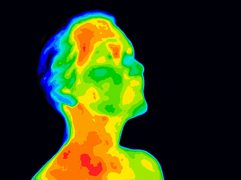 Thermographic image of a human face and neck showing different temperatures in a range of colors from blue cold to red hot. Red in the neck might indicate raised CR-P levels, this could be a sign of inflammation, and Carotid Artery inflammation which could be linked to a stroke.