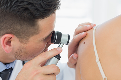 Closeup of male dermatologist checking mole on woman in clinic
