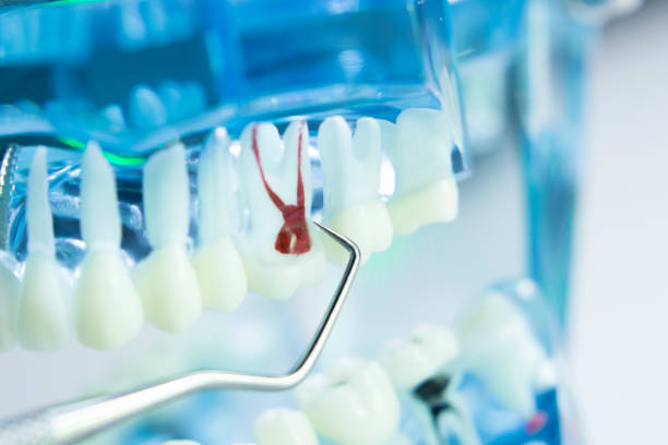 istock Dental teeth, mouth, gums dentists teaching model 843676040