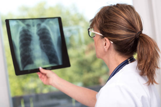 istock Female doctor examining x-ray report 843676062