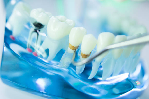 istock Dental teeth, mouth, gums dentists teaching model 843676068