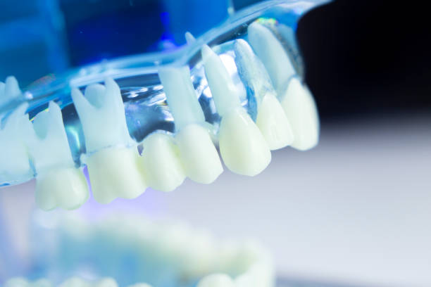 istock Dental teeth, mouth, gums dentists teaching model 843677676