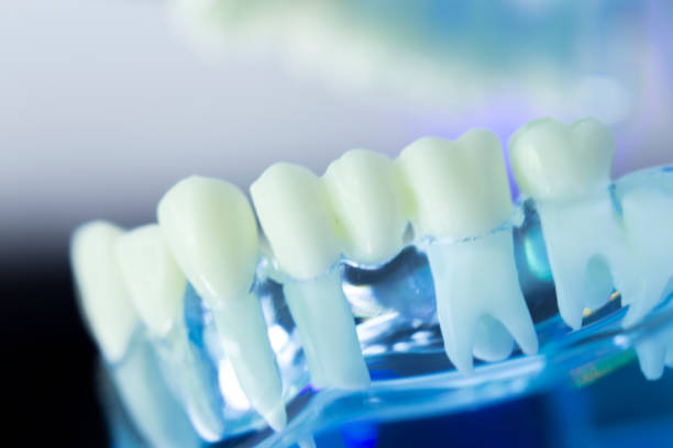 istock Dental teeth, mouth, gums dentists teaching model 843677678