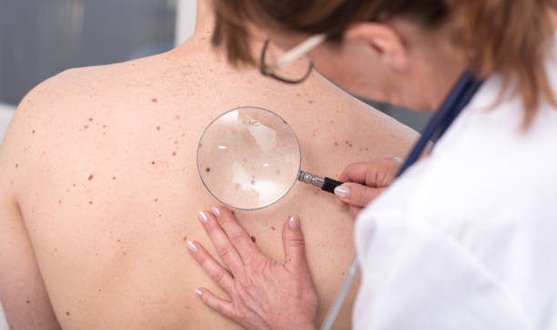 Dermatologist examining the skin of a patient stock photo
