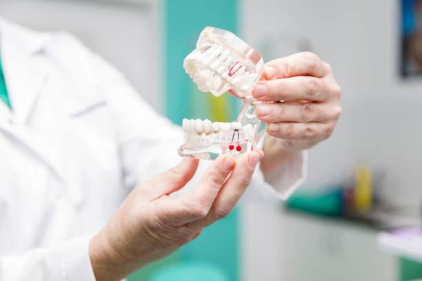 istock Female dentist holding in the hand dentures model 844012728