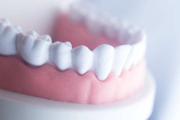 istock Dental tooth dentistry student learning teaching model showing teeth, roots, gums, gum disease, tooth decay and plaque 844114150