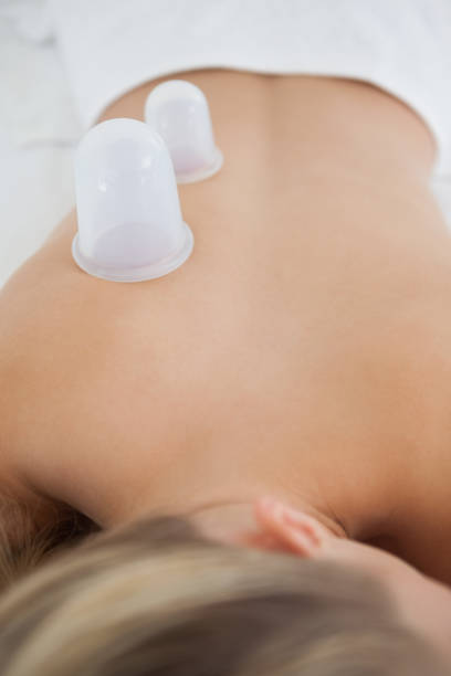 istock Pretty blonde with vacuum cups on her back 844316602