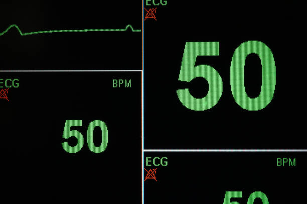 istock ECG monitor 845174686