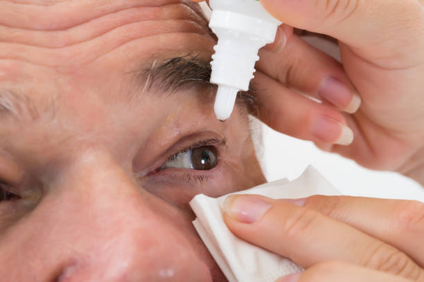 istock Optometrist Putting Eye Drops In Patient's Eye 845307744