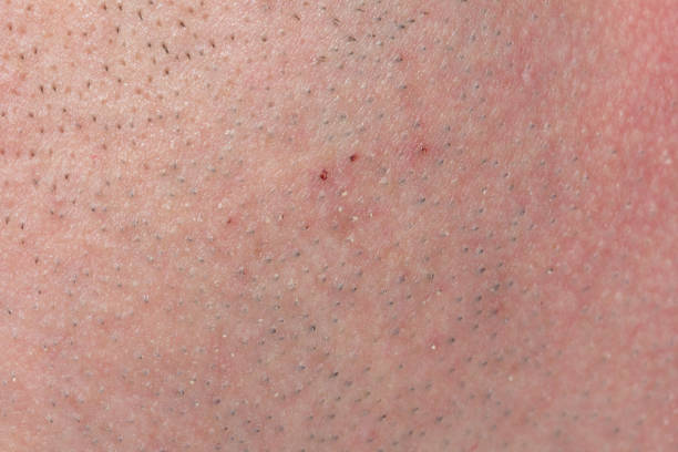 istock close up view of a human skin (series 845511754