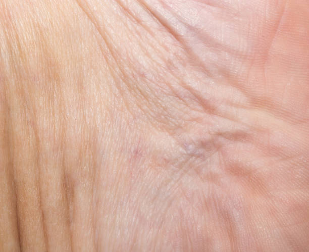 istock Background of the human skin. macro 845522948