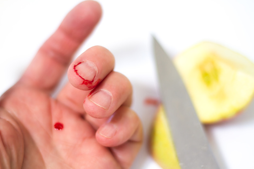Bloody knife wound in finger from cutting apple; close-up; white background with copy space