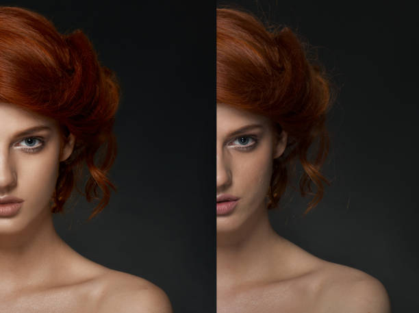 istock Woman face before and after cosmetic procedure. Plastic surgery concept. 845724932