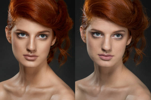 istock Woman face before and after cosmetic procedure. Plastic surgery concept. 845725030