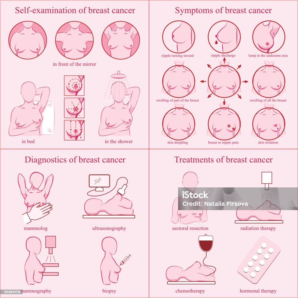 Establece el cáncer de mama. Examen de conciencia, síntomas, diagnósticos, tratamientos. - arte vectorial de Examen de senos libre de derechos