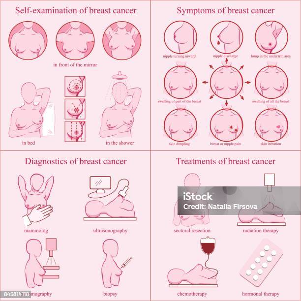 Ilustración de Establece El Cáncer De Mama Examen De Conciencia Síntomas Diagnósticos Tratamientos y más Vectores Libres de Derechos de Examen de senos