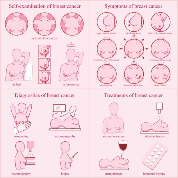 illustrations, cliparts, dessins animés et icônes de la valeur de cancer du sein. auto-examen, symptômes, diagnostic, traitements. - symptome