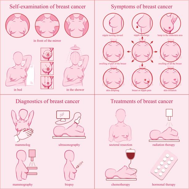 ilustrações, clipart, desenhos animados e ícones de conjunto de câncer de mama. auto-exame, sintomas, diagnóstico, tratamentos. - breast cancer
