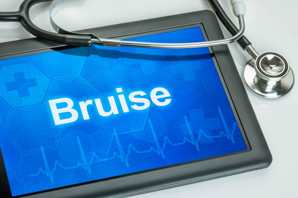 istock Tablet with the diagnosis Bruise on the display 845848724
