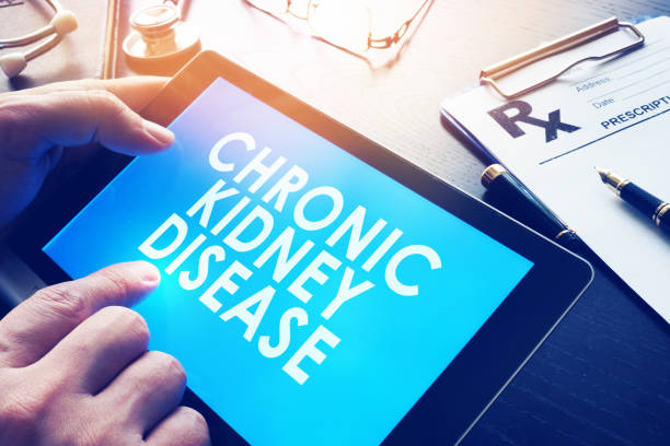 Doctor is reading about Chronic kidney disease (CKD). Doctor is reading about Chronic kidney disease (CKD). chronic illness stock pictures, royalty-free photos & images